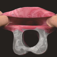 Y-2209L consolador hueco de silicona masculino cubierta de pene extendida y agrandada, juguete sexual para adultos - details 5