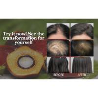 batana oil for hair growth
