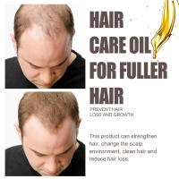 Mejora la sequedad, fortalece, nutre el cuero cabelludo y el cabello, aceite esencial para el cuidado del cabello. - details 6