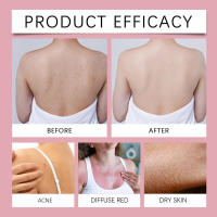Vanilla Body Care Hidratante suave Fragancia para la piel Aceite esencial calmante - details 6