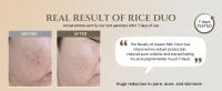 rice toner