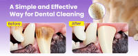 Toallitas para el cuidado sin enjuague, kit de cepillado de dientes, para limpieza de dientes de gato, cepillo de dientes Dental para eliminar placa y sarro, - details 2