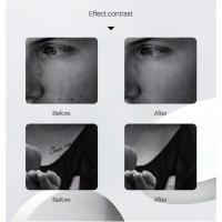 Láser Picosegundo Para Eliminación De Tatuajes Máquina De Láser Rojo/Azul Quema De Manchas Piel Pigmentada Eliminador De Vello Y Acné - details 9