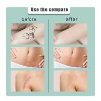 Adhesivo corrector de tono de piel, que cubre el cuerpo, marca de nacimiento, cicatriz, mancha de tatuaje, adhesivo de color impermeable - details 4