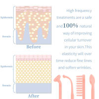 Varilla Electrode de Alta Frecuencia Dispositivo de Belleza para El Cuidado de la Piel - details 6