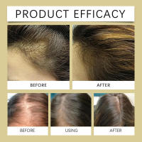 Romero de West&Montreal para hidratar el cabello, aceite esencial suave y nutritivo para el cuidado del cabello - details 6