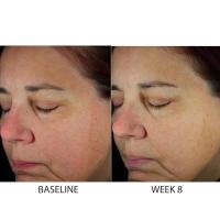 ZO N HLTH Brightalive 1.7oz/50ml. - details 3