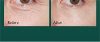 Crema Hidratante Contorno de Ojos, hidrata, humecta y mejora las ojeras - details 12