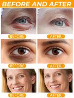 Crema de Ojos de Retinol Eliminación Inmediata de Ojeras Desvanecimiento de Líneas Finas - details 12