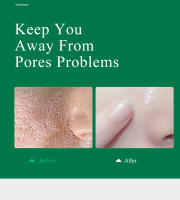 MABREM Granada poros finos suero facial planta blanqueadora cuidado de la piel crema antiarrugas antienvejecimiento Reduce el cuidado de las marcas de acné 10ml - details 5