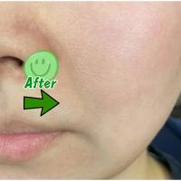 Suero corrector de manchas oscuras, crema blanqueadora hidratante para la piel Facial, Reduce las pecas, la opacidad, el acné y la melanina - details 12