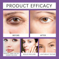 HOYGI Eye hidrata, reduce ligeramente las líneas finas alrededor de los ojos, levanta la piel, masajea y cuida la esencia de los ojos. - details 8