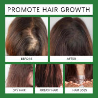 Rosemary Lightweight nutre suavemente el cuero cabelludo, dejando un aceite esencial para el cuidado del cabello suave y sedoso. - details 11