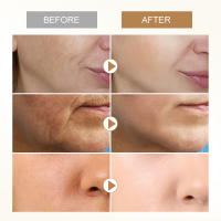 Crema para eliminar arrugas instantáneas, antienvejecimiento, líneas finas, Reduce las arrugas, Retinol, reafirmante, blanqueamiento, hidratante, piel facial - details 3