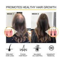 Hidrata, repara densamente las raíces, el cabello dañado, fortalece y reafirma el aceite esencial para el cuidado del cabello. - details 6