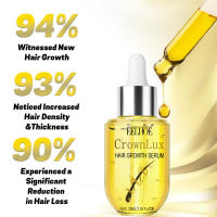 Previene la caída, nutre el cabello, cuidado del cuero cabelludo, esencia densa para el cuidado del cabello - details 3