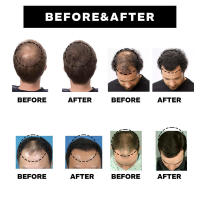 EAST MOON Care Follicles hidrata y nutre las raíces, esencia reafirmante para cabello denso y resistente. - details 8
