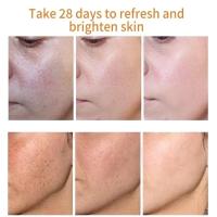 Crema Blanqueadora Astragalus Removedor de Manchas Dark Eyes Reparador de Melasma Hidratante - details 1