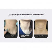 Masajeador de Cuello EMS Herramienta de Cuidado de la Piel para Eliminar Arrugas - details 5