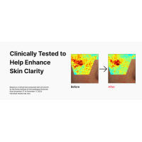 TIAM, Niacinamid Serum, Korean Skin Care