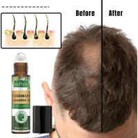 Tratamiento para el cuidado del cuero cabelludo con romero, raíces fuertes e hidratantes, bola de pelo gruesa para la línea del cabello - details 4