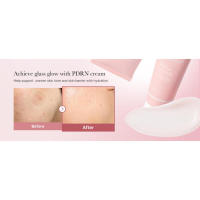 Crema Suavizante Rosa con Niacinamida Medicube Hidratante Reafirmante para Piel Irregular - details 3