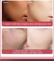 Artículos de belleza Microcorriente Calor frío Hogar Radiofrecuencia facial Instrumento de belleza Levantamiento y estiramiento - details 6