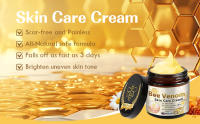 Bee Venom Skin Treatment Cream, Bee Venom Cream bee venom wart and tags removal treatment spray