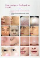 Dispositivo portátil de belleza para el hogar, lámpara LED grande, fotón, rejuvenecimiento de la piel, blanqueamiento de magnesio, eliminación de acné, fisioterapia infrarroja - details 8