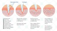 Sistema de rodillos de belleza 6 en 1, instrumento de agujas cosméticas y para el cuidado de la piel de titanio para la cara - details 1