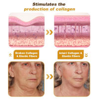 2025 nuevo estilo KELIHAWK 2 uds crema para eliminar arrugas Botox, crema hidratante facial, crema antienvejecimiento con veneno de abeja para todo tipo de piel - details 2
