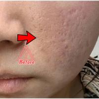 Suero corrector de manchas oscuras, crema blanqueadora hidratante para la piel Facial, Reduce las pecas, la opacidad, el acné y la melanina - details 14