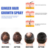 El jengibre nutre ligeramente el cabello, hidrata, suaviza, brilla e hidrata el spray para el cuidado del cabello - details 6