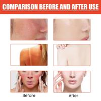 Crema Protector Solar Spf90 Bloqueador de Rayos UV Resistente a Quemaduras - details 10