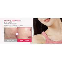 txa serum