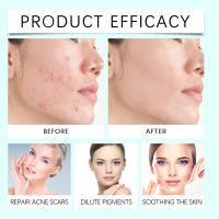 Hidratante Hidratante suave, suave, suave y delicado para la piel facial Crema de cuidado diario - details 11