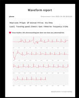 Reloj inteligente para hombre, dispositivo con control del azúcar en sangre, ECG, Bluetooth, llamadas, nuevo - details 10