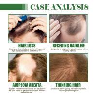 El crecimiento nutre y suaviza el cabello, repara las raíces, fortalece el cuidado, aceite esencial para el cabello Batana - details 6