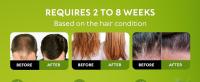batana oil for hair growth reviews after