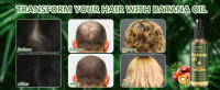 hair growing oil