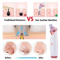 Removedor eléctrico de espinillas con succión al vacío, limpiador de acné del poro Facial recargable por USB, limpieza de manchas de comedón, Extractor de espinillas - details 3