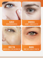 Pluma de belleza antiarrugas con círculo negro, dispositivos térmicos que se desvanecen, Crema para Ojos, herramientas de masaje con vibración de 42 ° - details 1