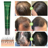 Esencia hidratante suave para el cuidado del cabello seco y jengibre para el cuero cabelludo - details 6