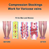 Calcetines deportivos de compresión sin pies para férula, venas varicosas, linfedema, correr, ciclismo, Mangas de soporte de pantorrilla, 1 par - details 5