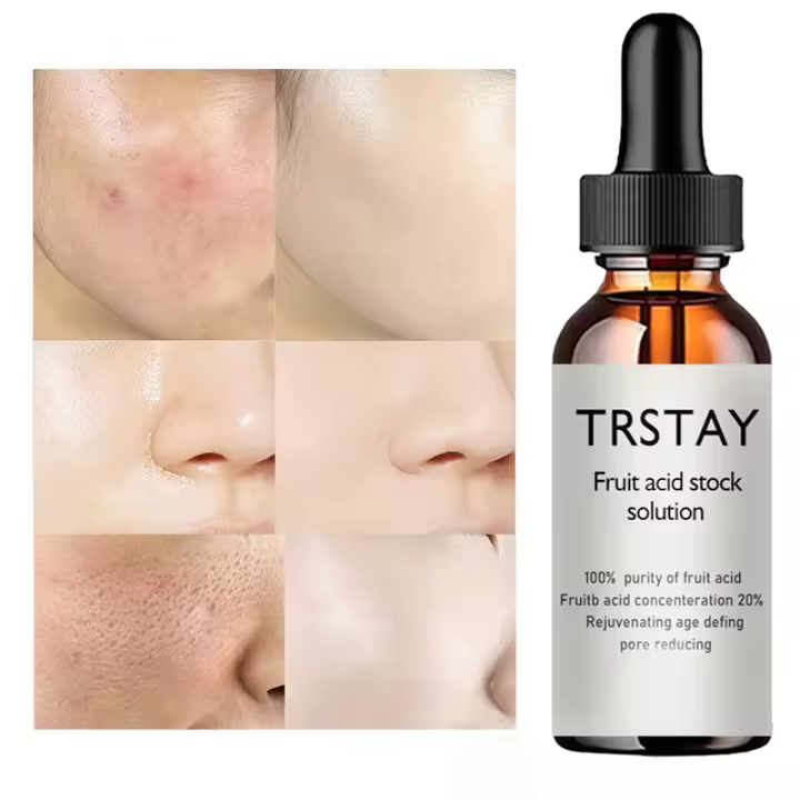 20% aceite de ácido glicólico líquido antiarrugas crema facial blanqueamiento cuidado de la piel suero antienvejecimiento productos para el cuidado de la piel - 1