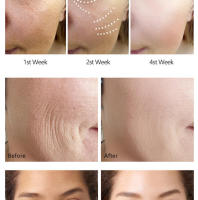 Suero de retinol hidratante reafirmante cuidado de la piel solución original cosmética - details 7