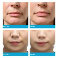 Mascarilla Facial de Colágeno Adiós a las Arrugas, Levanta y Hidrata Cuidado de Belleza Suave - details 4