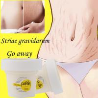 Crema reparadora de estrías Pasjel de Tailandia, 50ml, marcas potentes, cicatriz postparto, estiramiento Cr, removedor precioso para el cuerpo durante el embarazo Sk U0T0 - details 5