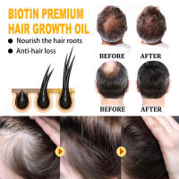La biotina hidrata profundamente y mejora el cuidado del cuero cabelludo, suaviza el aceite esencial para el cuidado del cabello. - details 7