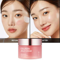 Crema de Gelatina de Colágeno Micro-agujas Faciales para Reducir Poros, Eliminar Comedones, Nourutar Piel Suave Herramientas de Cuidado de la Piel Facial - details 1